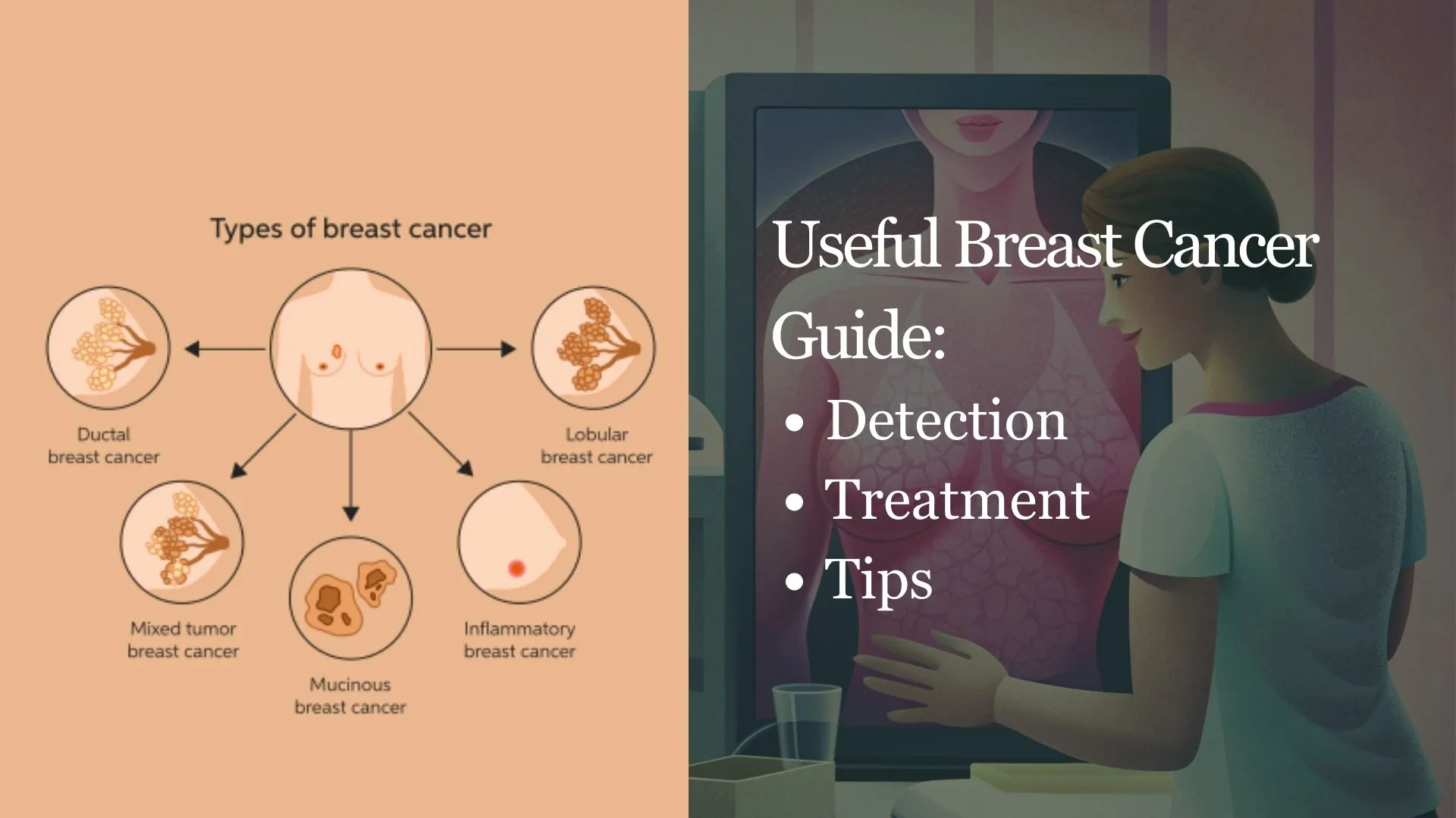 breast-cancer-types