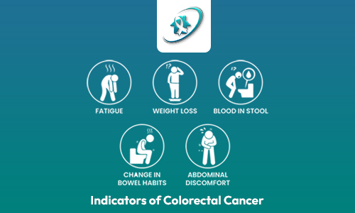 colorectal-cancer-indicators